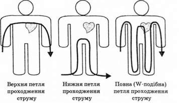 варіанти проходження електричного струму тілом