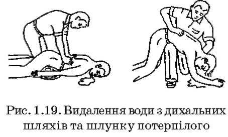 видалення води з дихальних шляхів та шлунку потерпілого