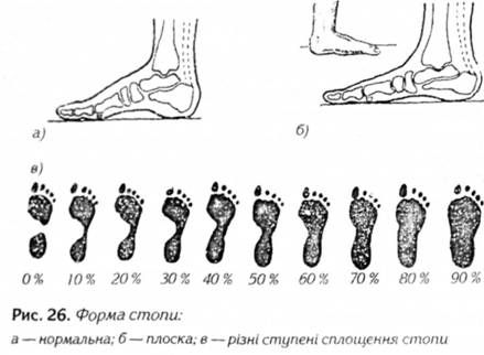 форма стопи 