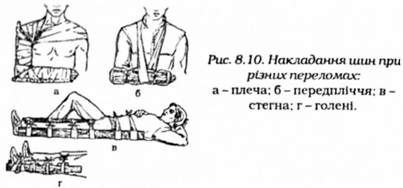накладання шин 