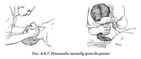 різновиди методу 
