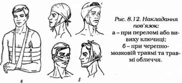 накладання пов'язок 