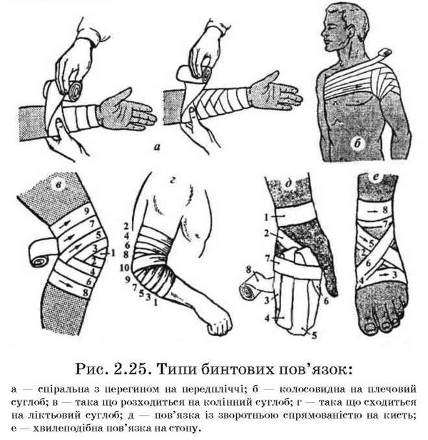 типи бинтових пов'язок 